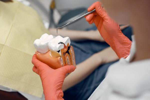 عوارض دندان خراب ؛ پوسیدگی دندان چه بلایی سر بقیه اعضای بدن می آورد؟