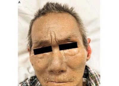 پرونده عجیب مردی که پوستش خاکستری شد (آرگیریا)، معمایی حل نشده و دلایل علمی این شرایط